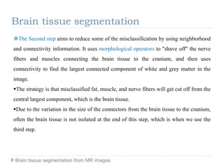 The Second step aims to reduce some of the misclassification by using neighborhood
and connectivity information. It uses morphological operators to "shave off" the nerve
fibers and muscles connecting the brain tissue to the cranium, and then uses
connectivity to find the largest connected component of white and grey matter in the
image.
The strategy is that misclassified fat, muscle, and nerve fibers will get cut off from the
central largest component, which is the brain tissue.
Due to the variation in the size of the connectors from the brain tissue to the cranium,
often the brain tissue is not isolated at the end of this step, which is when we use the
third step.
Brain tissue segmentation
Brain tissue segmentation from MR images
 