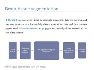 The third step uses expert input to annihilate connections between the brain and
spurious structures in a few carefully chosen slices of the data, and then employs
region based deformable contours to propagate the manually drawn contours to the
rest of the volume.
Brain tissue segmentation
Brain tissue segmentation from MR images
Input
Image
Remove
Gain
artifact
Using Morphological
operators
Using
deformable
contours
Output
Image
 