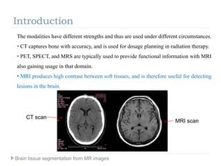 Introduction
The modalities have different strengths and thus are used under different circumstances.
• CT captures bone with accuracy, and is used for dosage planning in radiation therapy.
• PET, SPECT, and MRS are typically used to provide functional information with MRI
also gaining usage in that domain.
• MRI produces high contrast between soft tissues, and is therefore useful for detecting
lesions in the brain.
MRI scan
CT scan
Brain tissue segmentation from MR images
 