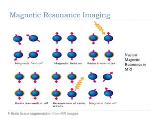 Magnetic Resonance Imaging
Nuclear
Magnetic
Resonance in
MRI
Brain tissue segmentation from MR images
 