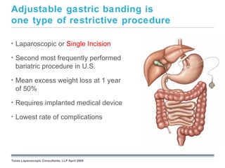 Adjustable gastric banding is
one type of restrictive procedure

•   Laparoscopic or Single Incision
•   Second most frequently performed
    bariatric procedure in U.S.
•   Mean excess weight loss at 1 year
    of 50%
•   Requires implanted medical device
•   Lowest rate of complications


                                                 September 26, 2008




Texas Laparoscopic Consultants, LLP April 2009
 