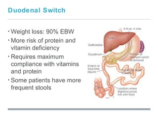 Duodenal Switch


• Weight  loss: 90% EBW
• More risk of protein and
  vitamin deficiency
• Requires maximum
  compliance with vitamins
  and protein
• Some patients have more
  frequent stools
                     September 26, 2008
 