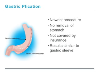 Gastric Plication


                          • Newest   procedure
                          • No removal of
                            stomach
                          • Not covered by
                            insurance
                          • Results similar to
                            gastric sleeve


                    September 26, 2008
 