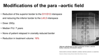 Modifications of the para –aortic field
• Reduction of the superior border to the D11/D12 interspace
and reducing the inferior border to the L4/L5 interspace
• Dose: 20Gy
• Median F/U: 7 years
• None of patient relapsed in cranially reduced border
• Reduction in treatment volume: 16%
 