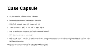 Case Capsule
• 44 year old male, Married and has 2 children
• Presented with Rt scrotal swelling since 4 months
• USG s/o Rt testicular mass with Rt para-ortic LN
• Tumor Markers: Sr AFP 2.45, Sr B-HCG <1.2, Sr LDH 186
• U/W Rt Orchiectomy through scrotal route in Outside hospital
• HPR: Classical seminoma Rt testis pT1
• CECT TAP: Rt testis is not seen. Lt testis unremarkable. Enlarged metastatic node in aortocaval region 1.9X1.6cm, 1.3X1cm in the
Left Para aortic region.
Diagnosis: Classical seminoma of Rt testis pT1N1M0S0 stage IIA
 