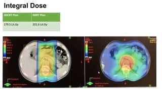 Integral Dose
3DCRT Plan IMRT Plan
179.5 Lit.Gy 201.6 Lit.Gy
 