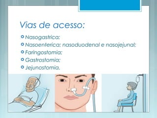 Vias de acesso:
 Nasogastrica;
 Nasoenterica; nasoduodenal e nasojejunal;
 Faringostomia;
 Gastrostomia;
 Jejunostomia.
 