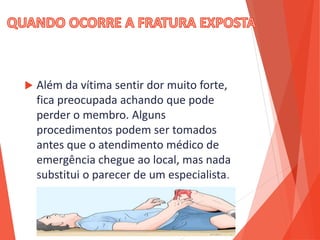  Além da vítima sentir dor muito forte,
fica preocupada achando que pode
perder o membro. Alguns
procedimentos podem ser tomados
antes que o atendimento médico de
emergência chegue ao local, mas nada
substitui o parecer de um especialista.
 