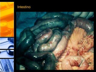 Intestino
 