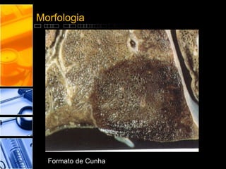 Morfologia
Formato de Cunha
 