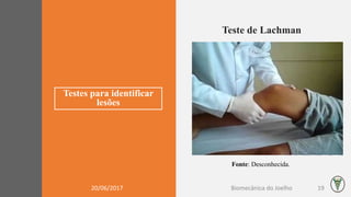 Testes para identificar
lesões
Teste de Lachman
Fonte: Desconhecida.
20/06/2017 Biomecânica do Joelho 19
 