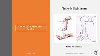 Testes para identificar
lesões
Teste de Steinmann
Fonte: Desconhecida.
20/06/2017 Biomecânica do Joelho 20
 