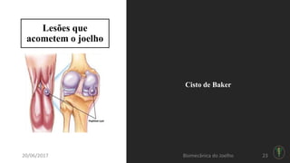 Lesões que
acometem o joelho
Cisto de Baker
2320/06/2017 Biomecânica do Joelho
 