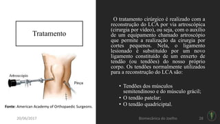 Tratamento
O tratamento cirúrgico é realizado com a
reconstrução do LCA por via artroscópica
(cirurgia por vídeo), ou seja, com o auxílio
de um equipamento chamado artroscópio
que permite a realização da cirurgia por
cortes pequenos. Nela, o ligamento
lesionado é substituído por um novo
ligamento constituído de um enxerto de
tendão (ou tendões) do nosso próprio
corpo. Os tendões normalmente utilizados
para a reconstrução do LCA são:
• Tendões dos músculos
semitendinoso e do músculo grácil;
• O tendão patelar;
• O tendão quadriciptal.Fonte: American Academy of Orthopaedic Surgeons.
20/06/2017 Biomecânica do Joelho 28
 