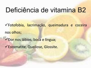 Deficiência de vitamina B2
Fotofobia, lacrimação, queimadura e coceira
nos olhos;
Dor nos lábios, boca e língua;
Estomatite, Queilose, Glossite.
 