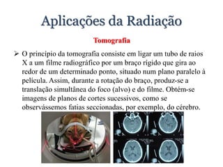 Aplicações da Radiação
Tomografia
 O princípio da tomografia consiste em ligar um tubo de raios
X a um filme radiográfico por um braço rígido que gira ao
redor de um determinado ponto, situado num plano paralelo à
película. Assim, durante a rotação do braço, produz-se a
translação simultânea do foco (alvo) e do filme. Obtém-se
imagens de planos de cortes sucessivos, como se
observássemos fatias seccionadas, por exemplo, do cérebro.
 