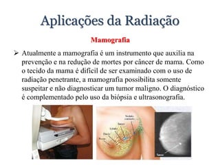 Aplicações da Radiação
Mamografia
 Atualmente a mamografia é um instrumento que auxilia na
prevenção e na redução de mortes por câncer de mama. Como
o tecido da mama é difícil de ser examinado com o uso de
radiação penetrante, a mamografia possibilita somente
suspeitar e não diagnosticar um tumor maligno. O diagnóstico
é complementado pelo uso da biópsia e ultrasonografia.
 