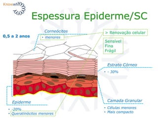 Espessura Epiderme/SC
0,5 a 2 anos
Camada Granular
• Células menores
• Mais compacto
Estrato Córneo
• - 30%
Epiderme
• -20%
• Queratinócitos menores
Corneócitos
• menores
> Renovação celular
Sensível
Fina
Frágil
 