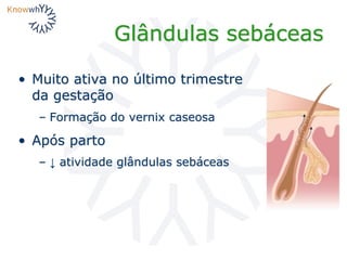 Glândulas sebáceas
• Muito ativa no último trimestre
da gestação
– Formação do vernix caseosa
• Após parto
– ↓ atividade glândulas sebáceas
 