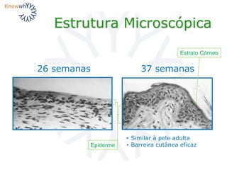 Estrutura Microscópica
26 semanas 37 semanas
Epiderme
Estrato Córneo
• Similar à pele adulta
• Barreira cutânea eficaz
 