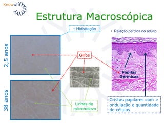 Estrutura Macroscópica
2,5anos38anos
Linhas de
microrrelevo
Glifos
Papilas
Dérmicas
↑ Hidratação
• Relação perdida no adulto
Cristas papilares com >
ondulação e quantidade
de células
 