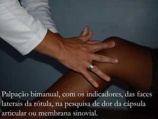 Palpação bimanual, com os indicadores, das faces
laterais da rótula, na pesquisa de dor da cápsula
articular ou membrana sinovial.
 