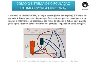 - Por meio de cânulas e tubos, o sangue venoso (pobre em oxigênio) é drenado do
paciente e levado para um sistema que fará as trocas gasosas, oxigenando esse
sangue e retornando ao organismo por meio de cânulas e tubos, com pressão
gerada pelo sistema e com isso mantendo a perfusão sanguínea em todos os órgãos;
© SC I C VESP - So cie d a d e d e C irurg ia C a rd io va s cula r d o Es ta d o d e Sã o P a ulo
COMO O SISTEMA DE CIRCULAÇÃO
EXTRACORPÓREA FUNCIONA?
 