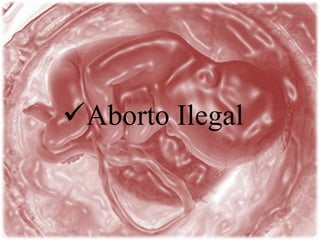 Aborto Ilegal
 