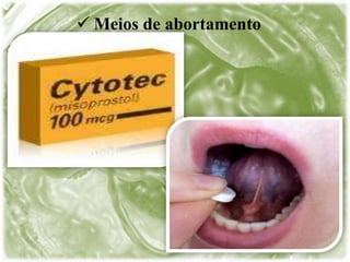  Meios de abortamento
 