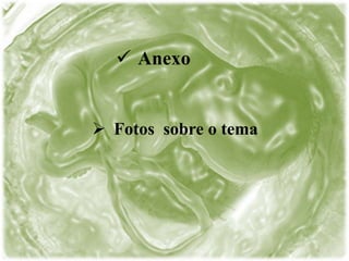  Anexo
 Fotos sobre o tema
 