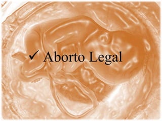  Aborto Legal
 