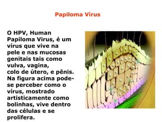 Papiloma Vírus


O HPV, Human
Papiloma Virus, é um
vírus que vive na
pele e nas mucosas
genitais tais como
vulva, vagina,
colo de útero, e pênis.
Na figura acima pode-
se perceber como o
vírus, mostrado
artisticamente como
bolinhas, vive dentro
das células e se
prolifera.
 