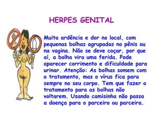 HERPES GENITAL

    Muita ardência e dor no local, com
•   pequenas bolhas agrupadas no pênis ou
    na vagina. Não se deve coçar, por que
    aí, a bolha vira uma ferida. Pode
    aparecer corrimento e dificuldade para
    urinar. Atenção: As bolhas somem com
    o tratamento, mas o vírus fica para
    sempre no seu corpo. Tem que fazer o
    tratamento para as bolhas não
    voltarem. Usando camisinha não passa
    a doença para o parceiro ou parceira. 
 