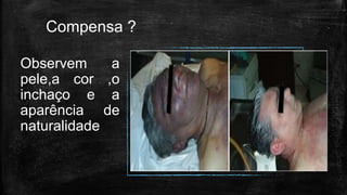 Compensa ?
Observem a
pele,a cor ,o
inchaço e a
aparência de
naturalidade
 