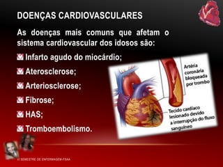 DOENÇAS CARDIOVASCULARES
As doenças mais comuns que afetam o
sistema cardiovascular dos idosos são:
Infarto agudo do miocárdio;
Aterosclerose;
Arteriosclerose;

Fibrose;
HAS;
Tromboembolismo.

VI SEMESTRE DE ENFERMAGEM-FSAA

 