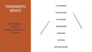 TRATAMENTO
BÁSICO
C7 SHENMEN
PC6 NEIGUAN
PC7 DALING
SISHENCONG
SHENTING
YINTANG
BP6 SANYINJIAO
EXPERIÊNCIA
CLÍNICA
AMBULATORIAL DA
AZYMEC
 