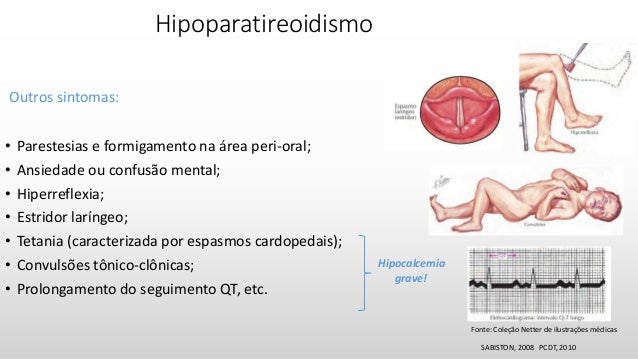 Calcemia exame