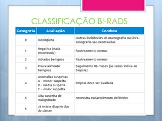 CLASSIFICAÇÃO BI-RADS
 