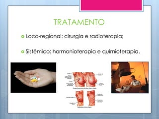 TRATAMENTO
 Loco-regional:   cirurgia e radioterapia;

 Sistêmico:   hormonioterapia e quimioterapia.
 