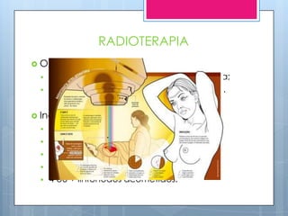RADIOTERAPIA
 Objetivos:
     Matar células remanescentes pós-cirurgia;
     Reduzir o tamanho do tumor pré-cirurgia.


 Indicações:
     Tumores com d > ou = a 5cm;
     Pele comprometida pelo tumor;
     Dissecção inadequada da axila;
     Margens comprometidas;
     4 ou + linfonodos acometidos.
 