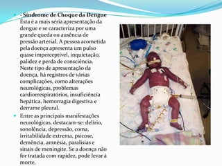  - Síndrome de Choque da Dengue
  Esta é a mais séria apresentação da
  dengue e se caracteriza por uma
  grande queda ou ausência de
  pressão arterial. A pessoa acometida
  pela doença apresenta um pulso
  quase imperceptível, inquietação,
  palidez e perda de consciência.
  Neste tipo de apresentação da
  doença, há registros de várias
  complicações, como alterações
  neurológicas, problemas
  cardiorrespiratórios, insuficiência
  hepática, hemorragia digestiva e
  derrame pleural.
 Entre as principais manifestações
  neurológicas, destacam-se: delírio,
  sonolência, depressão, coma,
  irritabilidade extrema, psicose,
  demência, amnésia, paralisias e
  sinais de meningite. Se a doença não
  for tratada com rapidez, pode levar à
  morte.
 