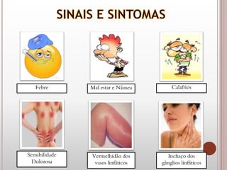 Febre Mal estar e Náusea Calafrios
Sensibilidade
Dolorosa
Vermelhidão dos
vasos linfáticos
Inchaço dos
gânglios linfáticos
 