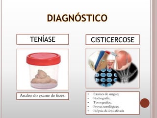 TENÍASE
Analise do exame de fezes.
CISTICERCOSE
• Exames de sangue;
• Radiografia;
• Tomografias;
• Provas sorológicas;
• Biópsia da área afetada
 