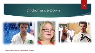 Síndrome de Down
13
Igor Maurer, Marcos Dynkoski, Guilherme Probst, Júlio Milesi
 