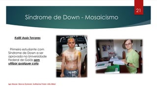 Síndrome de Down - Mosaicismo
21
Kallil Assis Tavares
Primeiro estudante com
Síndrome de Down a ser
aprovado na Universida...