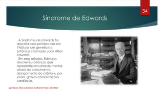 Síndrome de Edwards
A Síndrome de Edwards foi
descrita pela primeira vez em
1960 por um geneticista
britânico chamado John...