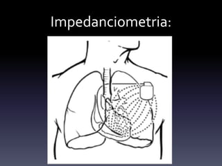 Impedanciometria:
 