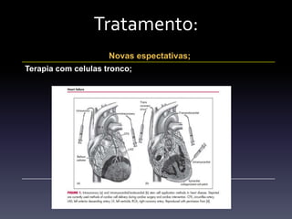 Tratamento:
                      Novas espectativas;
Terapia com celulas tronco;
 