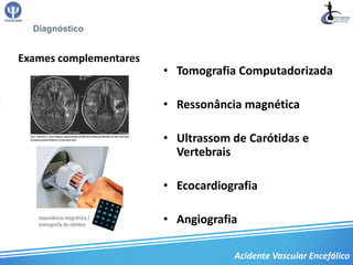 Diagnóstico


Exames complementares
                        • Tomografia Computadorizada

                        • Ressonância magnética

                        • Ultrassom de Carótidas e
                          Vertebrais

                        • Ecocardiografia

                        • Angiografia

                                    Acidente Vascular Encefálico
 