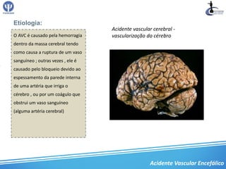 Etiologia:
                                   Acidente vascular cerebral -
O AVC é causado pela hemorragia    vascularização do cérebro
dentro da massa cerebral tendo
como causa a ruptura de um vaso
sanguíneo ; outras vezes , ele é
causado pelo bloqueio devido ao
espessamento da parede interna
de uma artéria que irriga o
cérebro , ou por um coágulo que
obstrui um vaso sanguíneo
(alguma artéria cerebral)




                                                   Acidente Vascular Encefálico
 